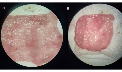 figure-results-4 Histological comparison, tissue samples A and B, microscope image, cellular structure analysis.