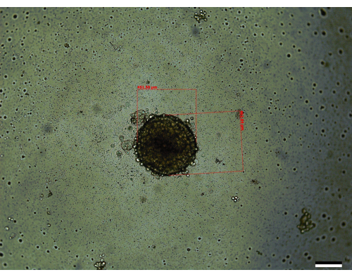 Microscope image of microbial colony growth with measurements for microbial analysis.