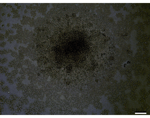 Microscope image of microbial colony growth pattern, displaying surface texture and organization.