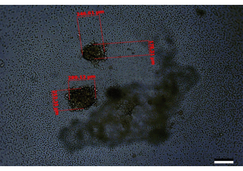 Cell size measurement, microscope image; digital analysis; cellular structure study; scale bar visible.