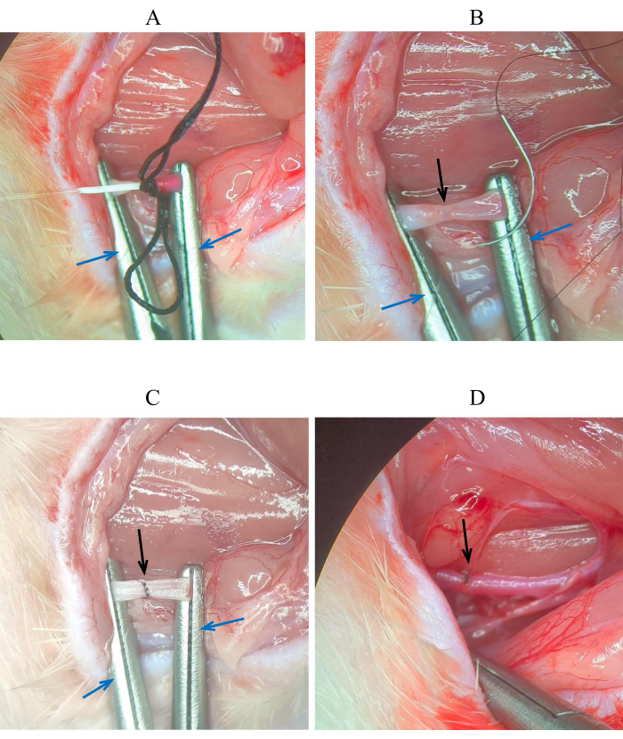 figure-results-1 Suturing technique in surgical procedure; sequence showing needle and thread use; medical diagram.