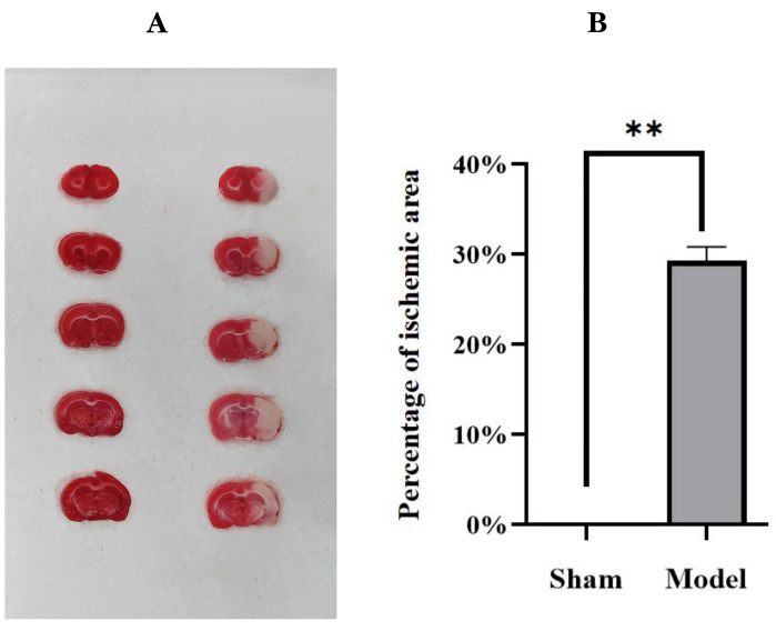 figure-results-2 Rat brain ischemia study: histological slices and ischemic area percentage bar graph comparison.