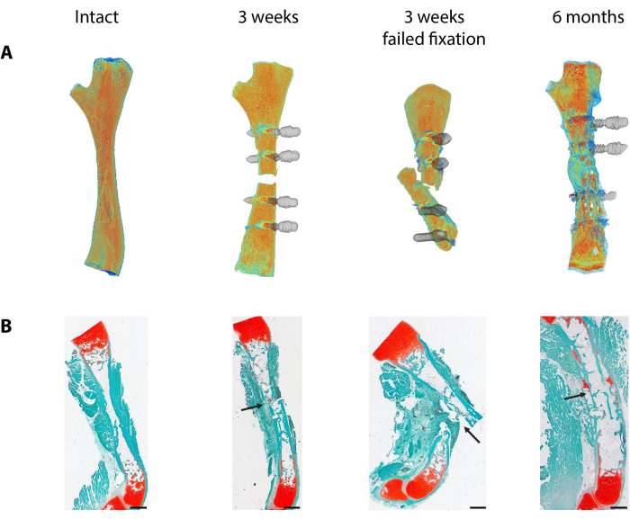 figure-results-3 骨愈合阶段示意图;随时间推移固定过程的3D模型与组织学图像。