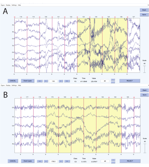 figure-results-3 EEG signal analysis graphs A-B, visualizing brain activity; data analysis, neurological research.