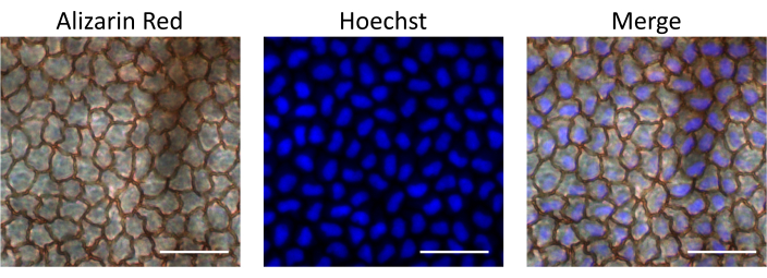 Microscopie cellulaire colorée : Rouge d’alizarine, Hoechst, fusionner ; processus d’imagerie ; résultats de microscopie.