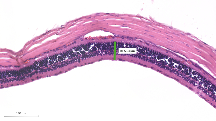 Histology section, retinal structure, microscope image, cellular layers, thickness measurement, microscopy.