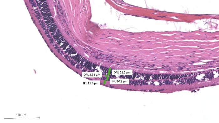 Retinal tissue section, microscopy image, shows OPL, IPL, ONL, INL layers with thickness measurements.