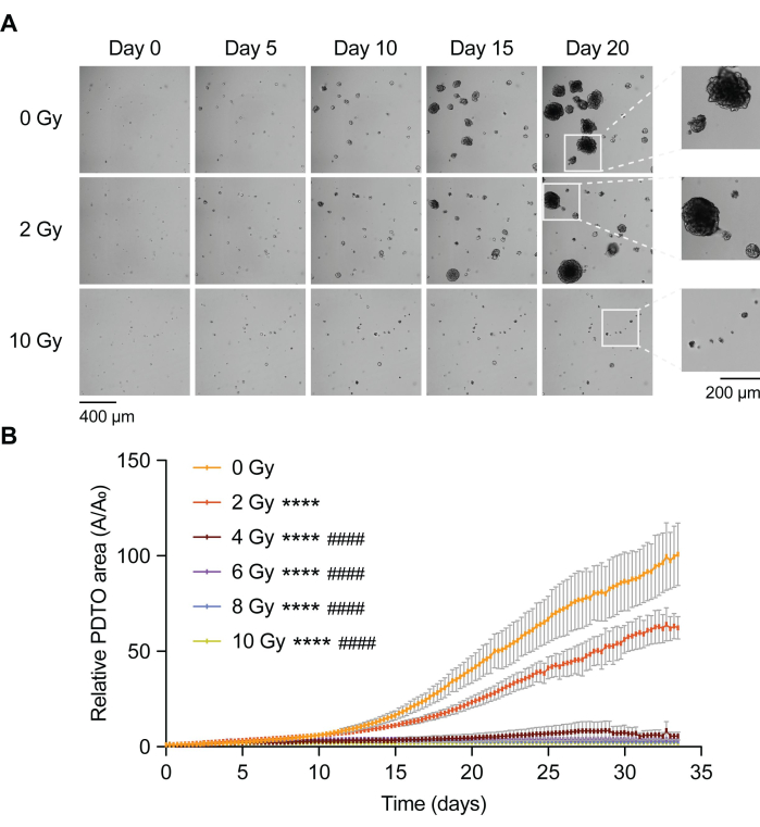 figure-results-1 Radiation response analysis; microscopic images and graph of organoid growth over time with Gy doses.