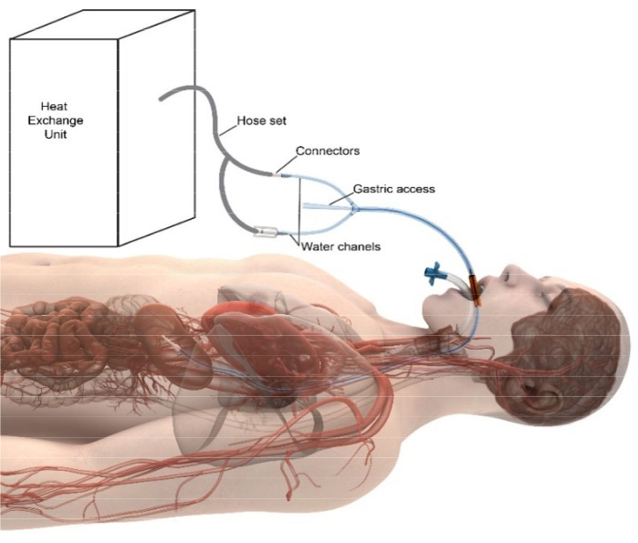 figure-introduction-2 Thermal regulation diagram with gastric cooling via heat exchange unit; blood flow visualization.