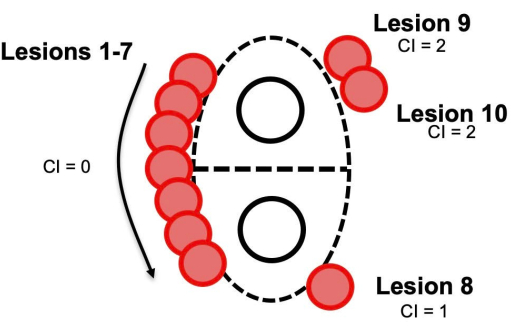 Static equilibrium diagram; lesions 1-10; CI=0-2, conceptual analysis of stability factors.