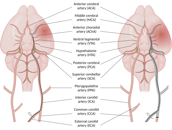 Cerebral artery anatomy diagram showing labeled arteries in the brain for educational study.