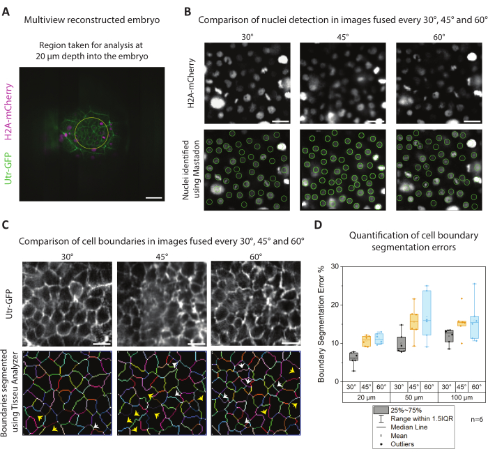 figure-results-6 Multiview reconstructed embryo; nuclei detection; cell boundary segmentation; error quantification chart.
