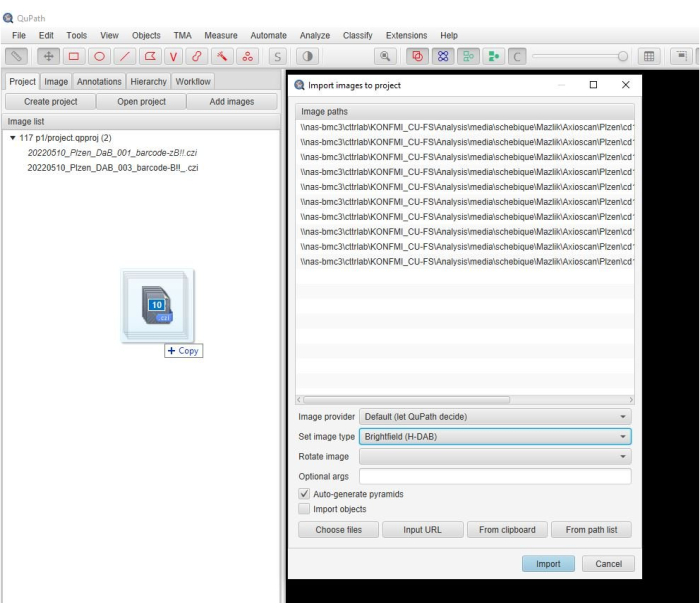 figure-results-2 QuPath interface for importing H-DAB brightfield microscopy images, showing file paths.