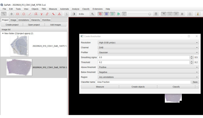 figure-results-3 QuPath software interface for image analysis; thresholding setup in DAB channel for histology.