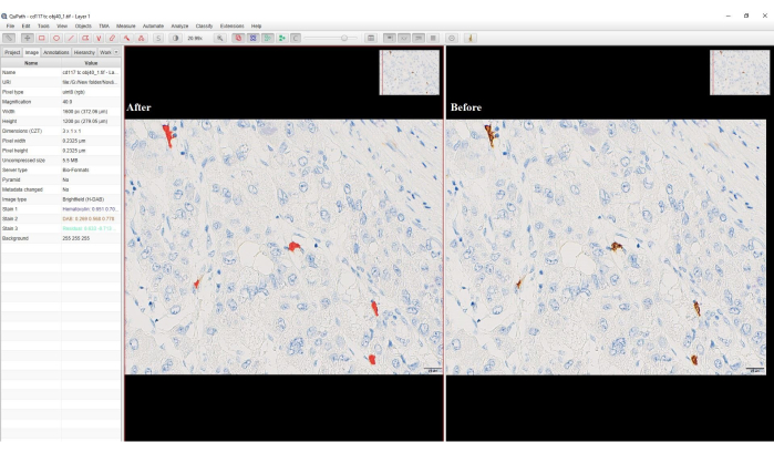 figure-results-4 Microscope image comparison showing tissue section analysis before and after treatment application.
