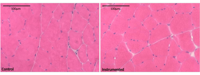 Histology comparison, muscle tissue; control vs. instrumented; microscope image; cellular structure.