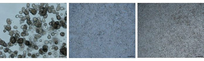 figure-results-2 Microscope image of cell aggregation and growth, depicting experimental cell culture conditions.
