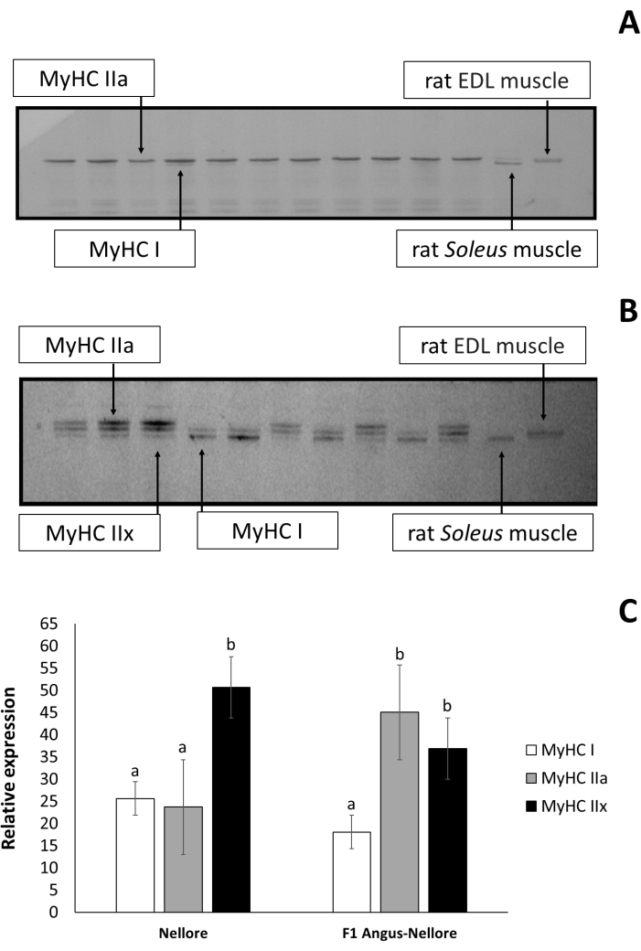 Electrophoresis of MyHC proteins in rat muscle; includes gel bands and bar chart for expression levels.