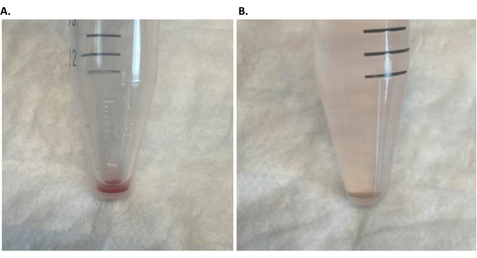 figure-results-2 Centrifugation results, conical tubes, sediment separation analysis, density gradient, lab experiment.