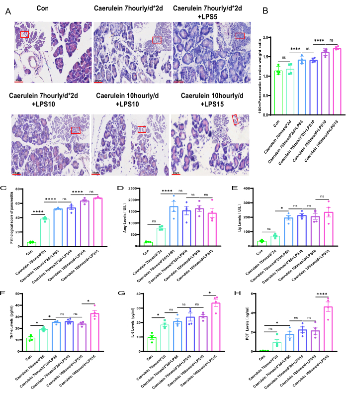 figure-results-3 Histological analysis and statistical comparison charts of pancreatic inflammation experimental study.
