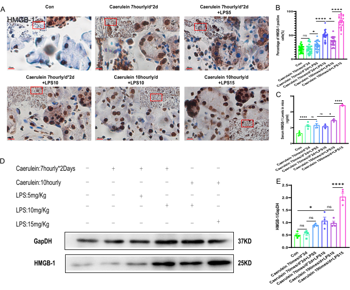 figure-results-5 Caerulein-induced pancreatitis analysis; histological images, protein expression, statistical graphs.