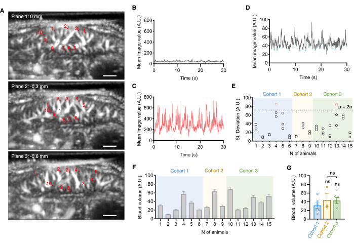 figure-results-4 Microscopy images, data charts; neurovascular analysis, plane depth comparison, statistical graphs.