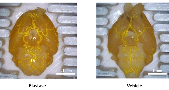 Elastase vs. vehicle-treated arterial wall thickness comparison, microscopy image, vascular study.