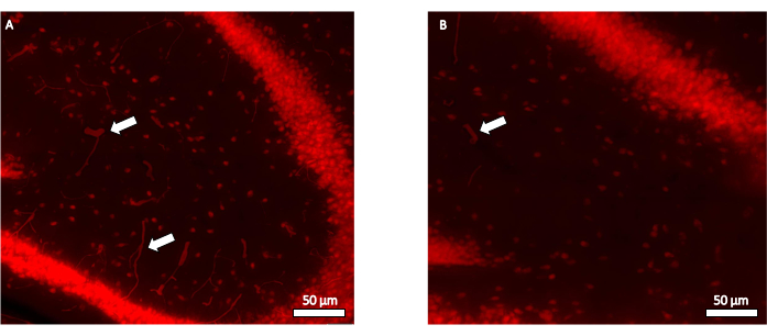 Fluorescence microscope images highlighting cell structures, arrows indicating specific features, 50µm scale.