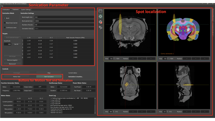 figure-results-2 Anzeige der Sonikationsparameter und MRI-Punktlokalisation für die Fokussierung der Ultraschallanalyse.