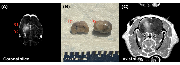 figure-results-3 Koronare und axiale Gehirnschnitte mit echten R1-, R2-Proben zur vergleichenden anatomischen Analyse.
