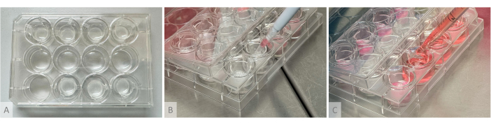 Cell culture in multiwell plate; pipetting; experiment process; laboratory technique; biological research.