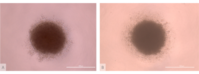 Microscopic images of cell culture spheroids, showing two different density patterns, 100 μm scale bar.