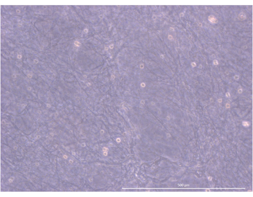 Microscope image of cell morphology; study of cell structure; magnification scale visible.