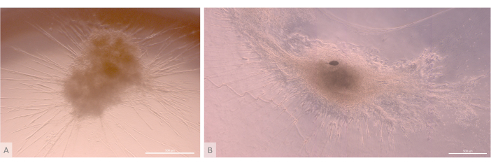 Microscope images of microbial colony growth patterns, showing radial expansion and colony formation.