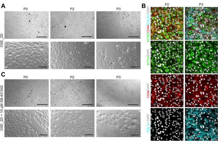 figure-results-2 Analisi della morfologia cellulare e dell'immunocolorazione; immagini al microscopio; Marcatori ACTIN/CD44/COL1A1/DAPI.
