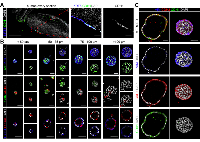 figure-results-4 Sezione ovarica umana colorata con KRT8, CDH1 e DAPI. Analisi al microscopio a immunofluorescenza.