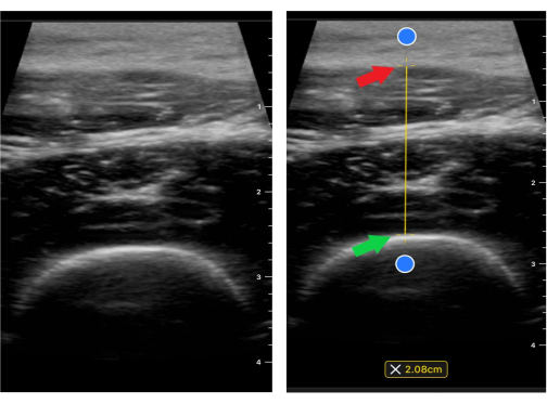 figure-results-2 Ultrasound imaging diagram; measuring anatomical structure; medical diagnostic process.