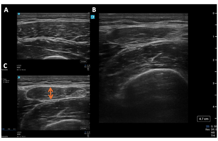 figure-results-4 Ultrasound imaging, medical diagnostic, cross-section analysis, soft tissue examination, clinical result.