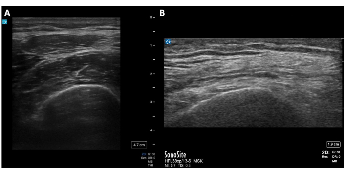 figure-results-6 Ultrasound imaging; musculoskeletal analysis; horizontal vs vertical view; diagnostic application.