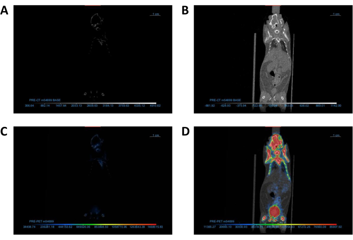 figure-protocol-1 CT and PET scan images showing comparative analysis in diagnostic imaging study.