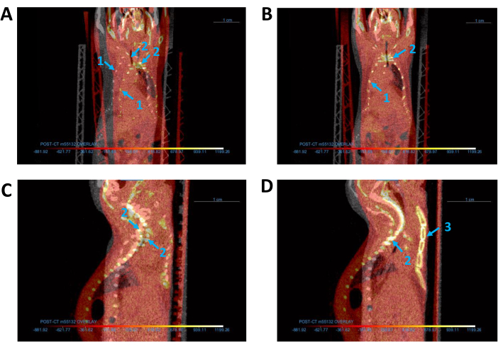 figure-protocol-2 CT scan medical imaging, anatomical structure comparison, labeled diagram, for diagnostic analysis.
