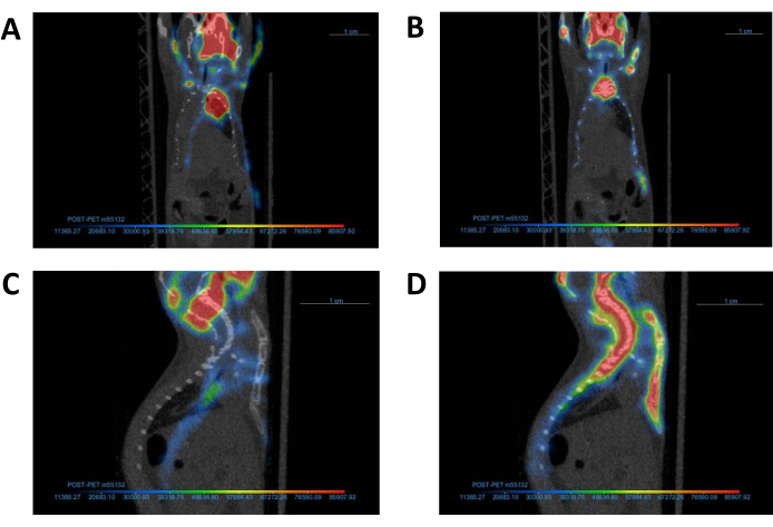 figure-protocol-3 PET scan results; four-panel comparison of tracer uptake in human body regions, color-coded intensity.