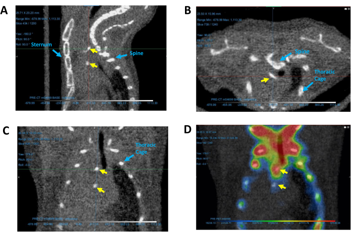figure-protocol-4 Thoracic anatomy CT scan series with labels for sternum, spine, and thoracic cage; medical imaging analysis.