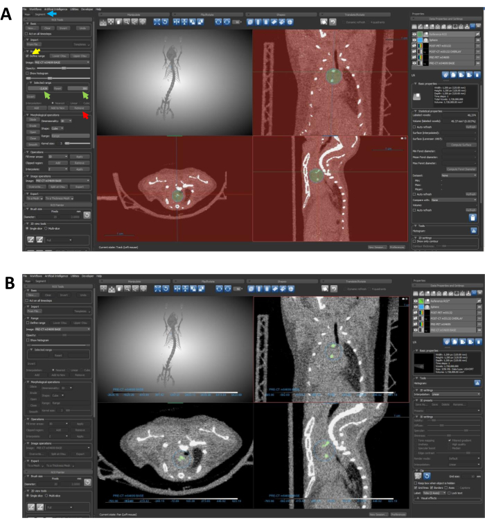 figure-protocol-5 CT scan analysis diagram with cross-sections for vascular system examination and digital modeling.