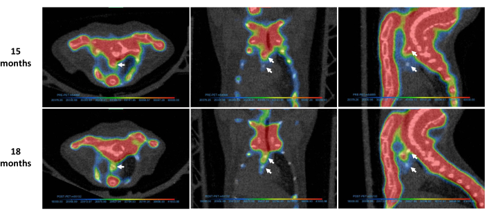 figure-results-1 PET scan progression for 15-18 months; tumor growth analysis, metabolic activity, radiotracer uptake.