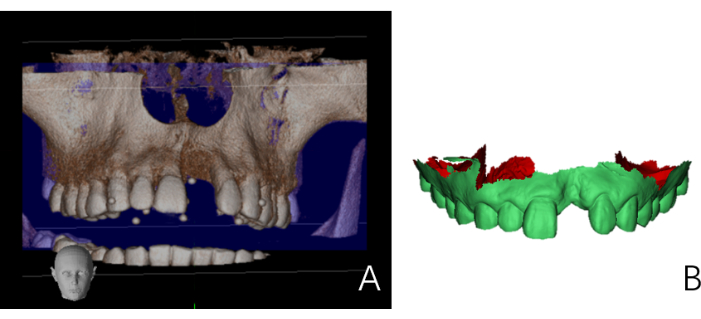 Dental 3D imaging, tomography analysis, jaw structure, and teeth visualization, medical diagram.
