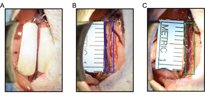 figure-protocol-5 Tooth measurement; clinical procedure images with ruler for gum recession evaluation.