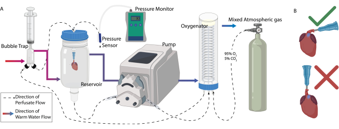 figure-results-1 Static equilibrium diagram of perfusion system; bubble trap, pump, oxygenator, pressure monitor.