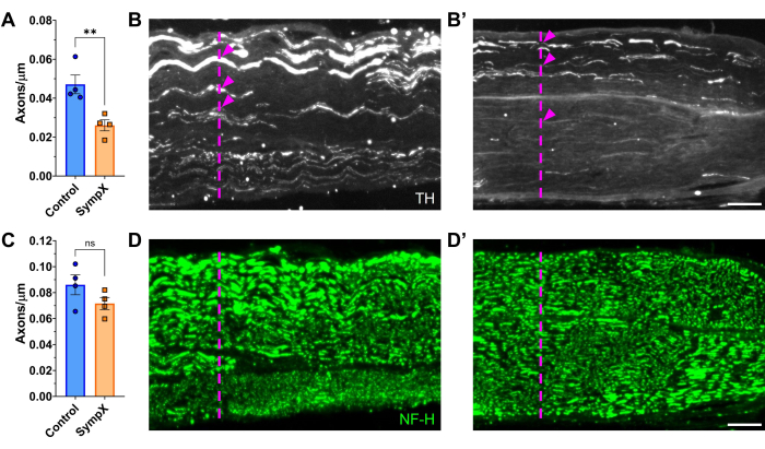 Analisi della densità degli assoni, confronto tra grafici a barre, gruppi di controllo e gruppi SynprX, microscopia a fluorescenza.