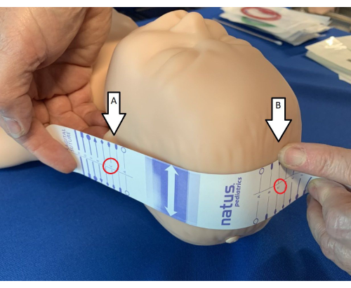 figure-results-1 Newborn head circumference measurement, using flexible tape, medical training demonstration.